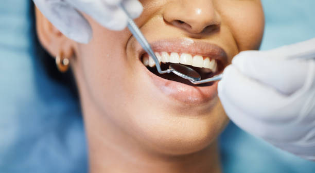 Best Broken or Cracked Tooth Emergency Dentist in Sewalls Point, FL